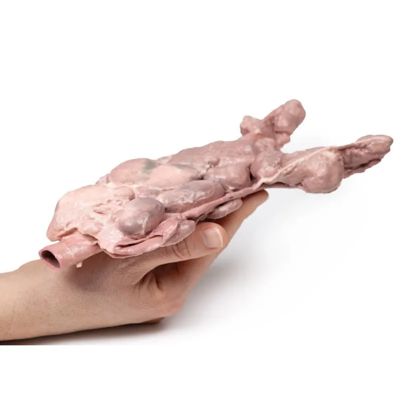 3D Printed Aorta & Para-aortic Lymph Nodes