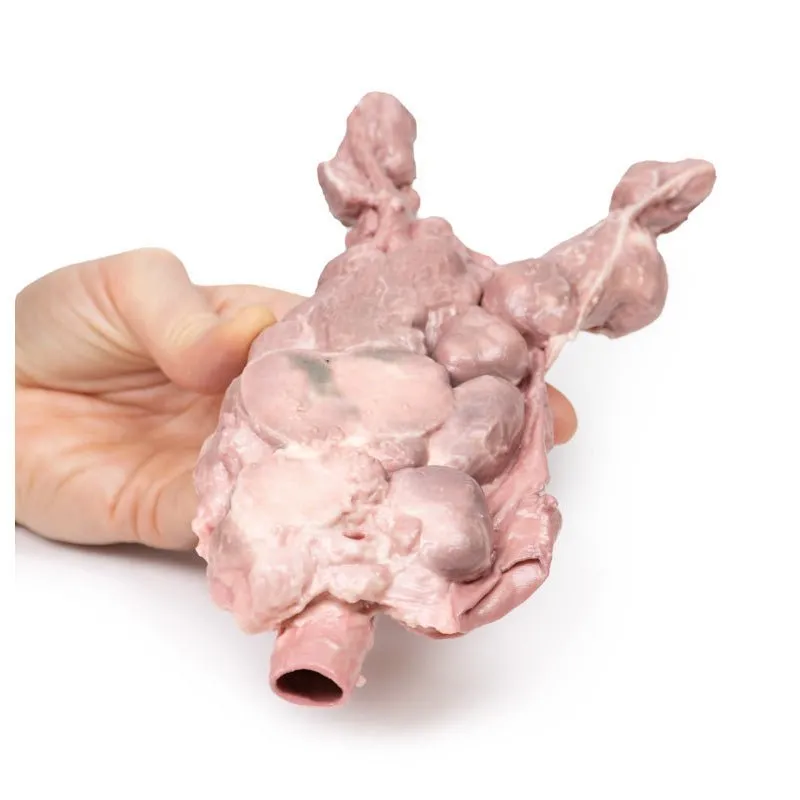 3D Printed Aorta & Para-aortic Lymph Nodes