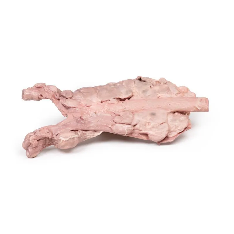 3D Printed Aorta & Para-aortic Lymph Nodes