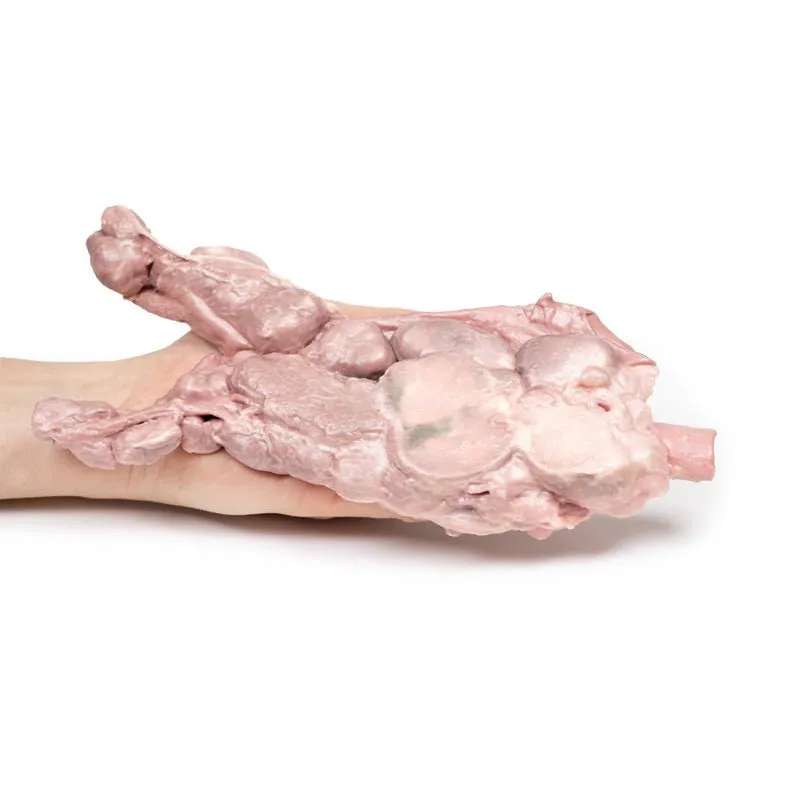 3D Printed Aorta & Para-aortic Lymph Nodes